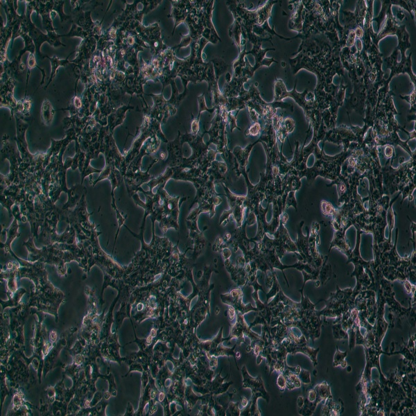 小鼠骨髓瘤细胞在癌症治疗策略开发中的应用