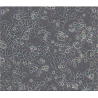 NCI-H1793人肺癌細胞