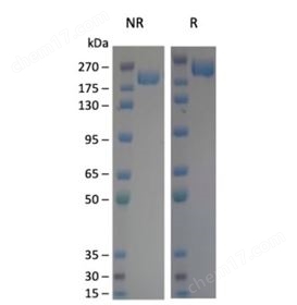 Spike Trimer (S1+S2) (XBB.1, Omicron Variant), His-Tag (SARS-CoV-2) Recombinant