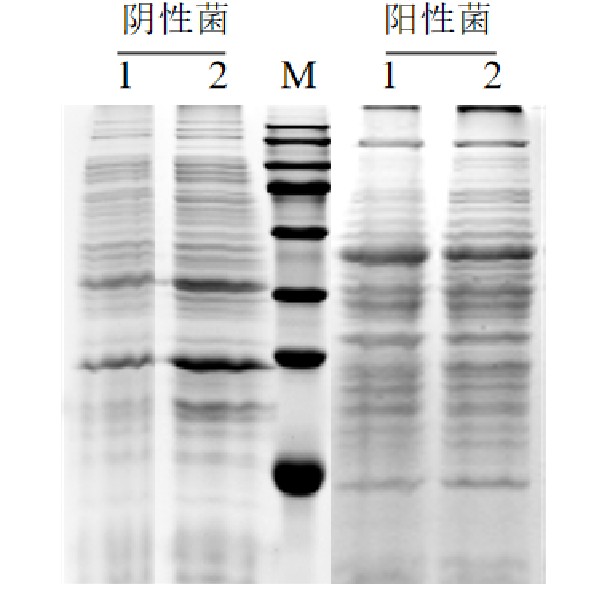 關(guān)于Ultra細(xì)菌膜蛋白提取試劑盒的介紹