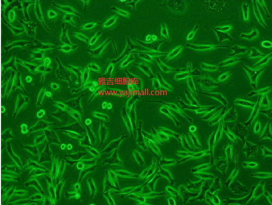 细胞培养过程中常见的生物性污染有哪些