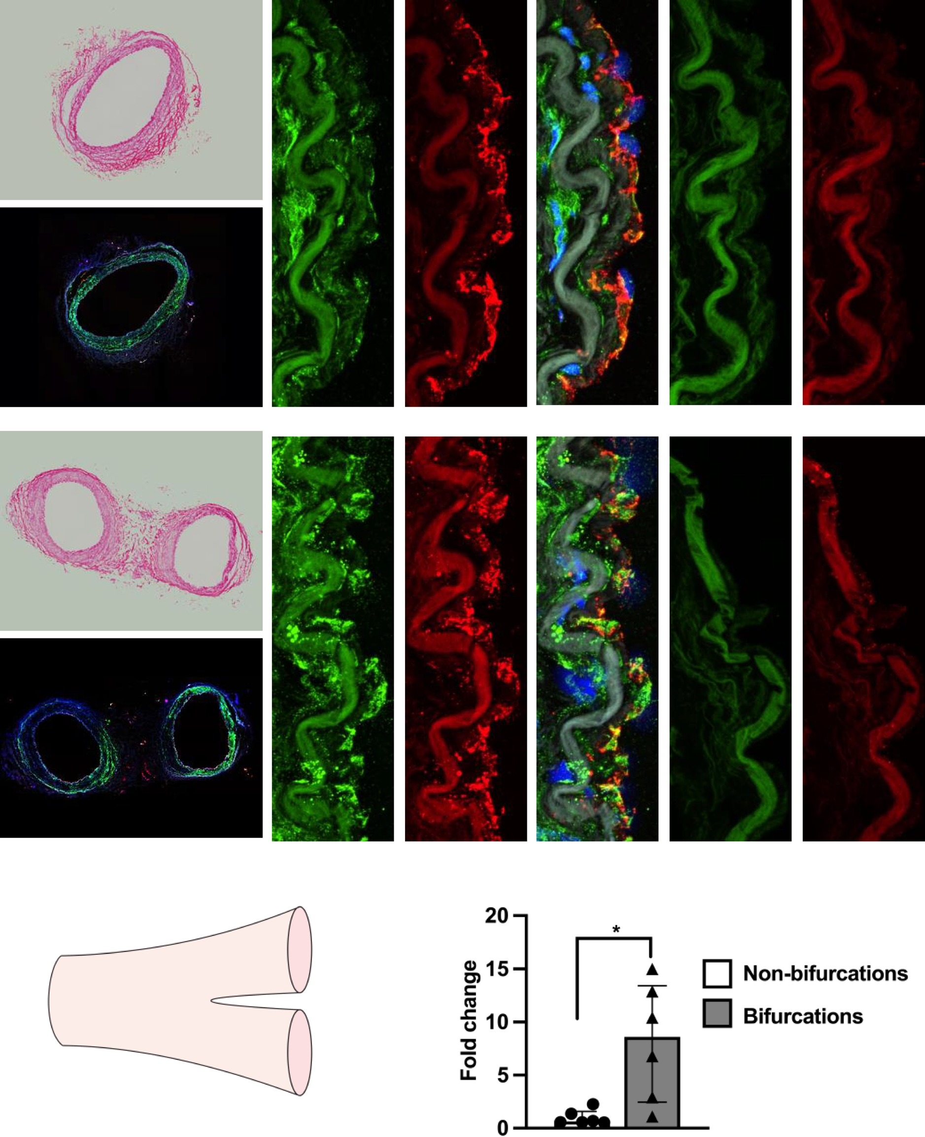 12/15-脂氧合酶介导血流紊乱诱导的内皮功能障碍与动脉粥样硬化