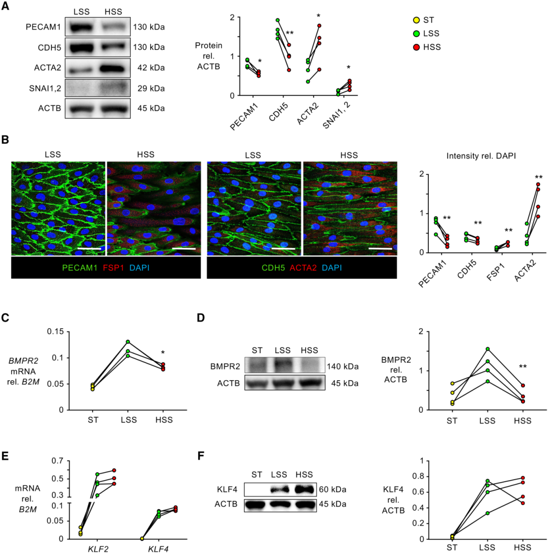 高剪切应力降低 ERG，导致内皮细胞间充质转化和肺动脉高压