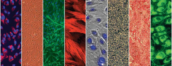 LONZA原代人肺微血管内皮细胞HMVEC-L 产品介绍